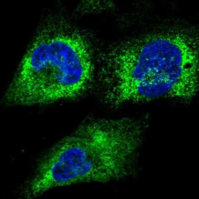 Immunocytochemistry/Immunofluorescence: RCN2 Antibody [NBP2-32010] - Staining of human cell line U-251 MG shows localization to endoplasmic reticulum. Antibody staining is shown in green.