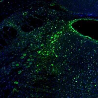 Immunohistochemistry: RCN2 Antibody [NBP2-32010] - Staining of mouse locus coeruleus shows immunoreactivity in neurons.