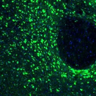 Immunohistochemistry: RCN2 Antibody [NBP2-32010] - Staining of mouse thalamus shows positivity in neurons of the parafascicular nucleus.