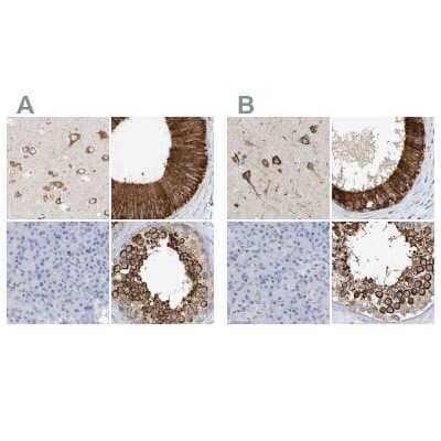 <b>Independent Antibodies Validation. </b>Immunohistochemistry-Paraffin: RCN2 Antibody [NBP2-32010] - Staining of human cerebral cortex, epididymis, pancreas and testis using Anti-RCN2 antibody NBP2-32010 (A) shows similar protein distribution across tissues to independent antibody NBP2-32011 (B).