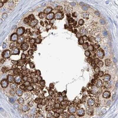 Immunohistochemistry-Paraffin: RCN2 Antibody [NBP2-32010] - Staining of human testis.