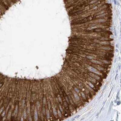 Immunohistochemistry-Paraffin: RCN2 Antibody [NBP2-32010] - Staining of human epididymis.