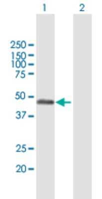 Western Blot: RCN2 Antibody [H00005955-B01P] - Analysis of RCN2 expression in transfected 293T cell line by RCN2 polyclonal antibody.  Lane 1: RCN2 transfected lysate(34.87 KDa). Lane 2: Non-transfected lysate.