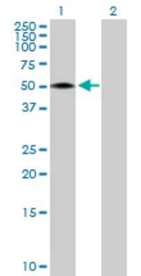 Western Blot: RCN2 Antibody [H00005955-D01P] - Analysis of RCN2 expression in transfected 293T cell line by RCN2 polyclonal antibody.Lane 1: RCN2 transfected lysate(36.90 KDa).Lane 2: Non-transfected lysate.