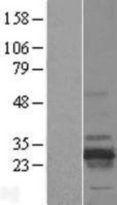 Western Blot RD3 Overexpression Lysate