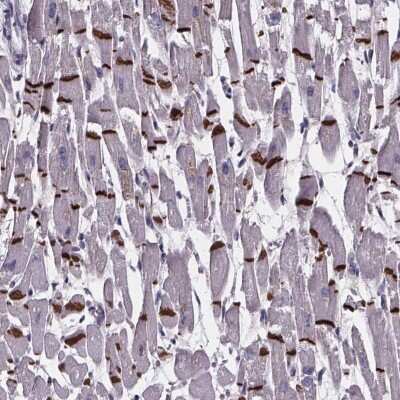 Immunohistochemistry: RD3L Antibody [NBP2-49539] - Staining of human heart muscle shows strong positivity in intercalated discs of myocytes.