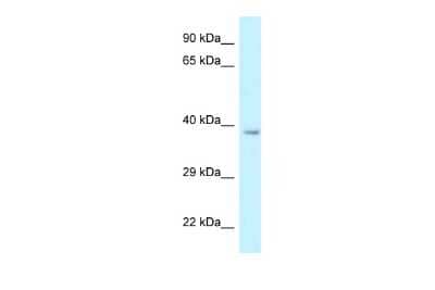 Western Blot: RDH10 Antibody [NBP2-85617] - WB Suggested Anti-Rdh10 Antibody. Titration: 1.0 ug/ml. Positive Control: Rat Liver