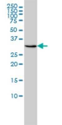 Western Blot: RDH11 Antibody (1H6) [H00051109-M01] - RDH11 monoclonal antibody (M01), clone 1H6 Analysis of RDH11 expression in Hela.