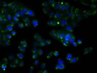 Immunocytochemistry/Immunofluorescence: RDH11 Antibody (OTI1B4) - Azide and BSA Free [NBP2-73843] - Staining of HT29 cells using anti-RDH11 mouse monoclonal antibody.