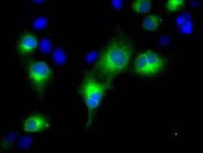 Immunocytochemistry/Immunofluorescence: RDH11 Antibody (OTI1B4) - Azide and BSA Free [NBP2-73843] - Staining of COS7 cells transiently transfected by pCMV6-ENTRY RDH11.