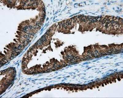 Immunohistochemistry: RDH11 Antibody (OTI1B4) - Azide and BSA Free [NBP2-73843] - Staining of paraffin-embedded prostate tissue using anti-RDH11 mouse monoclonal antibody.