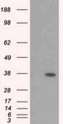 Western Blot: RDH11 Antibody (OTI1B4) - Azide and BSA Free [NBP2-73843] - HEK293T cells were transfected with the pCMV6-ENTRY control (Left lane) or pCMV6-ENTRY RDH11 (Right lane) cDNA for 48 hrs and lysed. Equivalent amounts of cell lysates (5 ug per lane) were separated by SDS-PAGE and immunoblotted with anti-RDH11.