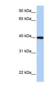 Western Blot: RDH11 Antibody [NBP1-57976] - Human Heart lysate, concentration 0.2-1 ug/ml.