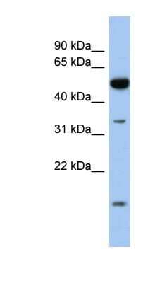 Western Blot: RDH12 Antibody [NBP1-58017] - Human Fetal Intestine, concentration 0.2-1 ug/ml.