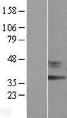 Western Blot: RDH12 Overexpression Lysate (Adult Normal) [NBL1-15256] Left-Empty vector transfected control cell lysate (HEK293 cell lysate); Right -Over-expression Lysate for RDH12.