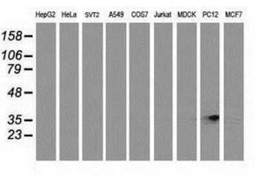 Western Blot: RDH14 Antibody (1A7) [NBP2-03667] Analysis of extracts (35ug) from 9 different cell lines by using anti-RDH14 monoclonal antibody.