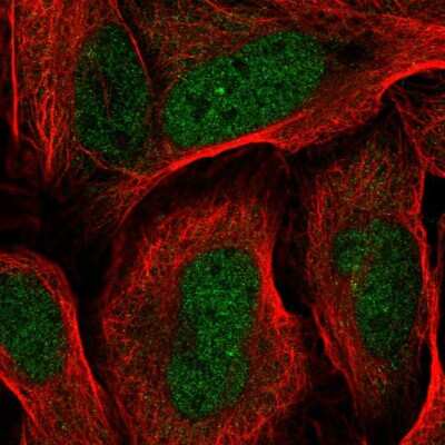Immunocytochemistry/Immunofluorescence: RDH14 Antibody [NBP2-31647] - Immunofluorescent staining of human cell line U-2 OS shows localization to nucleoplasm.