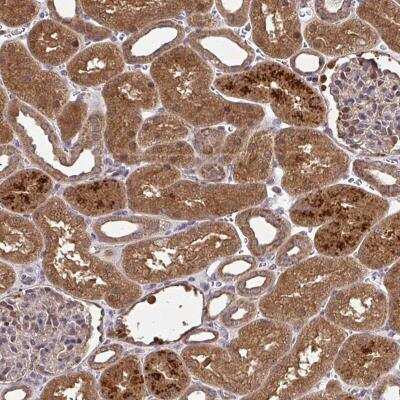 Immunohistochemistry-Paraffin: RDH14 Antibody [NBP2-31647] - Staining of human kidney shows strong cytoplasmic positivity in cells in tubules.
