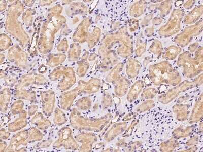 Immunohistochemistry-Paraffin: RDH14 Antibody [NBP3-06302] - Immunochemical staining of human RDH14 in human kidney with rabbit polyclonal antibody at 1:100 dilution, formalin-fixed paraffin embedded sections.