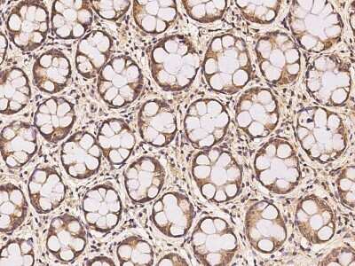 Immunohistochemistry-Paraffin: RDH14 Antibody [NBP3-06302] - Immunochemical staining of human RDH14 in human rectum with rabbit polyclonal antibody at 1:100 dilution, formalin-fixed paraffin embedded sections.