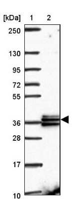 Western Blot RDH14 Antibody - BSA Free