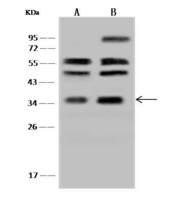 Western Blot: RDH14 Antibody [NBP3-06302] - Anti-RDH14 rabbit polyclonal antibody at 1:500 dilutionLane A: HEK293 Whole Cell LysateLane B: PC3 Whole Cell LysateLysates/proteins at 30 ug per lane.SecondaryGoat Anti-Rabbit IgG (H+L) HRP at 110000 dilution.Developed using the ECL technique.Performed under reducing conditions.Predicted band size:36 kDaObserved band size:36 kDa(We are unsure as to the identity of these extra bands.)