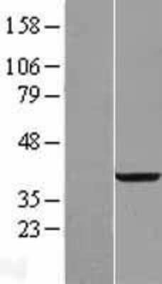 Western Blot: RDH14 Overexpression Lysate (Adult Normal) [NBL1-15258] Left-Empty vector transfected control cell lysate (HEK293 cell lysate); Right -Over-expression Lysate for RDH14.