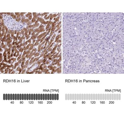 Immunohistochemistry-Paraffin RDH16 Antibody