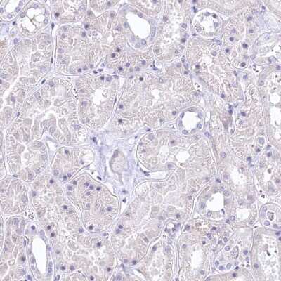 Immunohistochemistry-Paraffin RDH16 Antibody