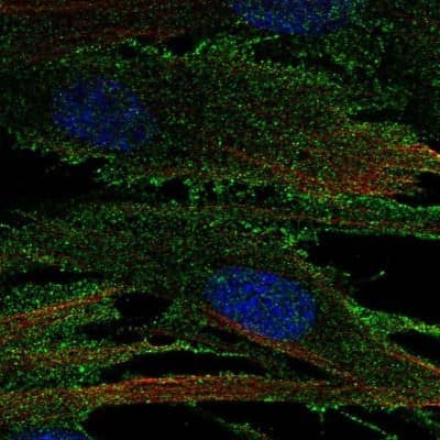 Immunocytochemistry/ Immunofluorescence RECK Antibody