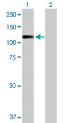 Western Blot: RECK Antibody [H00008434-D01P] - Analysis of RECK expression in transfected 293T cell line by RECK polyclonal antibody.Lane 1: RECK transfected lysate(106.50 KDa).Lane 2: Non-transfected lysate.