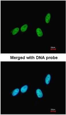 Immunocytochemistry/Immunofluorescence: RED Antibody [NBP1-30927] - Analysis of HeLa, using NBP1-30927 at 1:200 dilution.