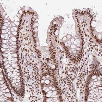 Immunohistochemistry: RED Antibody [NBP2-38591] - Staining of human colon shows strong nuclear positivity in  endothelial cells, glandular cells and peripheral nerve/ganglion.