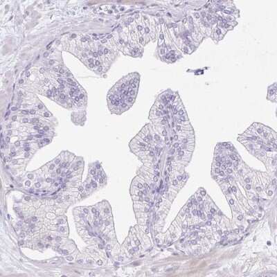 Immunohistochemistry-Paraffin: REEP1 Antibody [NBP2-34095] - Staining of human prostate shows low expression as expected.