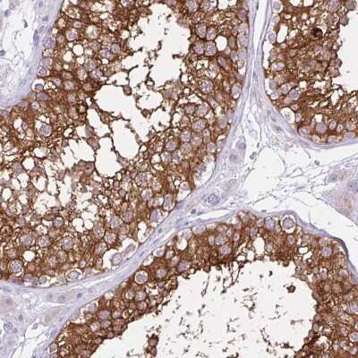 Immunohistochemistry-Paraffin: REEP1 Antibody [NBP2-34095] - Staining of human testis shows high expression.