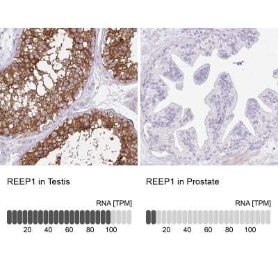 <b>Orthogonal Strategies Validation. </b>Immunohistochemistry-Paraffin: REEP1 Antibody [NBP2-34095] - Staining in human testis and prostate tissues using anti-REEP1 antibody. Corresponding REEP1 RNA-seq data are presented for the same tissues.