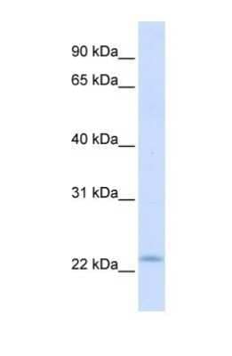 Western Blot: REEP1 Antibody [NBP1-69643] - This Anti-REEP1 antibody was used in Western Blot of Fetal Muscle tissue lysate at a concentration of 1ug/ml.