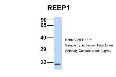 Western Blot: REEP1 Antibody [NBP1-69643] - Human Fetal Brain, Antibody Dilution: 1.0 ug/ml.