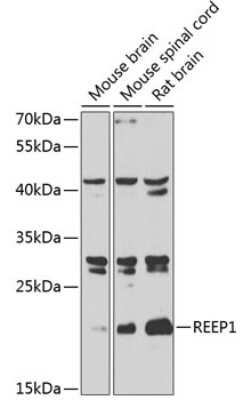 Western Blot: REEP1 Antibody [NBP2-94227] - Analysis of extracts of various cell lines, using REEP1 at 1:1000 dilution. Secondary antibody: HRP Goat Anti-Rabbit IgG (H+L) at 1:10000 dilution. Lysates/proteins: 25ug per lane. Blocking buffer: 3% nonfat dry milk in TBST. Detection: ECL Basic Kit . Exposure time: 90s.