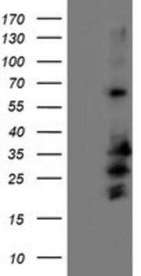 Western Blot: REEP2 Antibody (OTI2C7) - Azide and BSA Free [NBP2-73849] - HEK293T cells were transfected with the pCMV6-ENTRY control (Left lane) or pCMV6-ENTRY REEP2 (Right lane) cDNA for 48 hrs and lysed. Equivalent amounts of cell lysates (5 ug per lane) were separated by SDS-PAGE and immunoblotted with anti-REEP2.