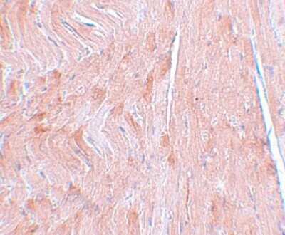 Immunohistochemistry-Paraffin: REEP3 Antibody [NBP1-77105] - Mouse heart tissue with REEP3 antibody at 5 ug/mL.