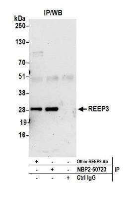Immunoprecipitation: REEP3 Antibody [NBP2-60723] - Detection of human REEP3 by western blot of immunoprecipitates. Samples: Whole cell lysate (0.5 or 1.0 mg per IP reaction; 20% of IP loaded) from HeLa cells prepared using NETN lysis buffer. Antibodies: Affinity purified rabbit anti-REEP3 antibody NBP2-60723 used for IP at 8 ul per reaction. REEP3 was also immunoprecipitated by another rabbit anti-REEP3 antibody. Detection: Chemiluminescence with an exposure time of 30 seconds.