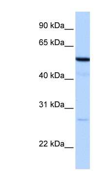 Western Blot: REEP4 Antibody [NBP1-62509] - HepG2 cell lysate, concentration 0.2-1 ug/ml.