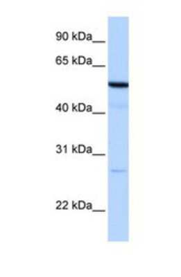 Western Blot: REEP4 Antibody [NBP1-69521] - This Anti-REEP4 antibody was used in Western Blot of HepG2 tissue lysate at a concentration of 1ug/ml.