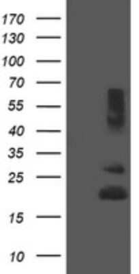 Western Blot: REEP5 Antibody (4D2) [NBP2-45945] - Analysis of HEK293T cells were transfected with the pCMV6-ENTRY control (Left lane) or pCMV6-ENTRY REEP5.