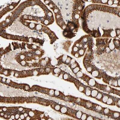 Immunohistochemistry-Paraffin: REEP5 Antibody [NBP1-86775] - Staining of human small intestine shows strong cytoplasmic positivity in glandular cells.