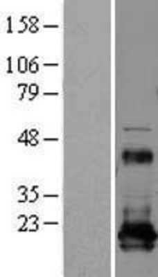 Western Blot: REEP5 Overexpression Lysate (Adult Normal) [NBL1-15269] Left-Empty vector transfected control cell lysate (HEK293 cell lysate); Right -Over-expression Lysate for REEP5.