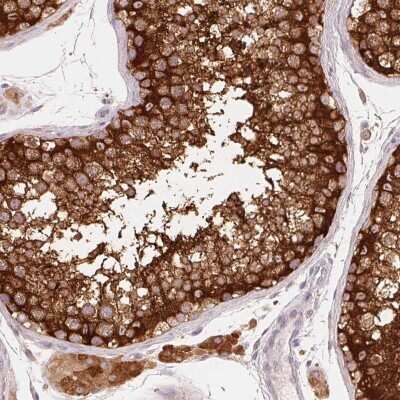 Immunohistochemistry: REEP6 Antibody [NBP2-37919] - Staining of human testis shows strong cytoplasmic and membranous positivity.