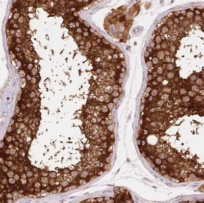 Immunohistochemistry-Paraffin: REEP6 Antibody [NBP2-37919] - Staining of human testis shows strong granular cytoplasmic positivity in cells in seminiferous ducts.
