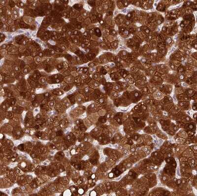 Immunohistochemistry-Paraffin: REEP6 Antibody [NBP2-37919] - Staining of human liver shows strong granular cytoplasmic positivity in hepatocytes.